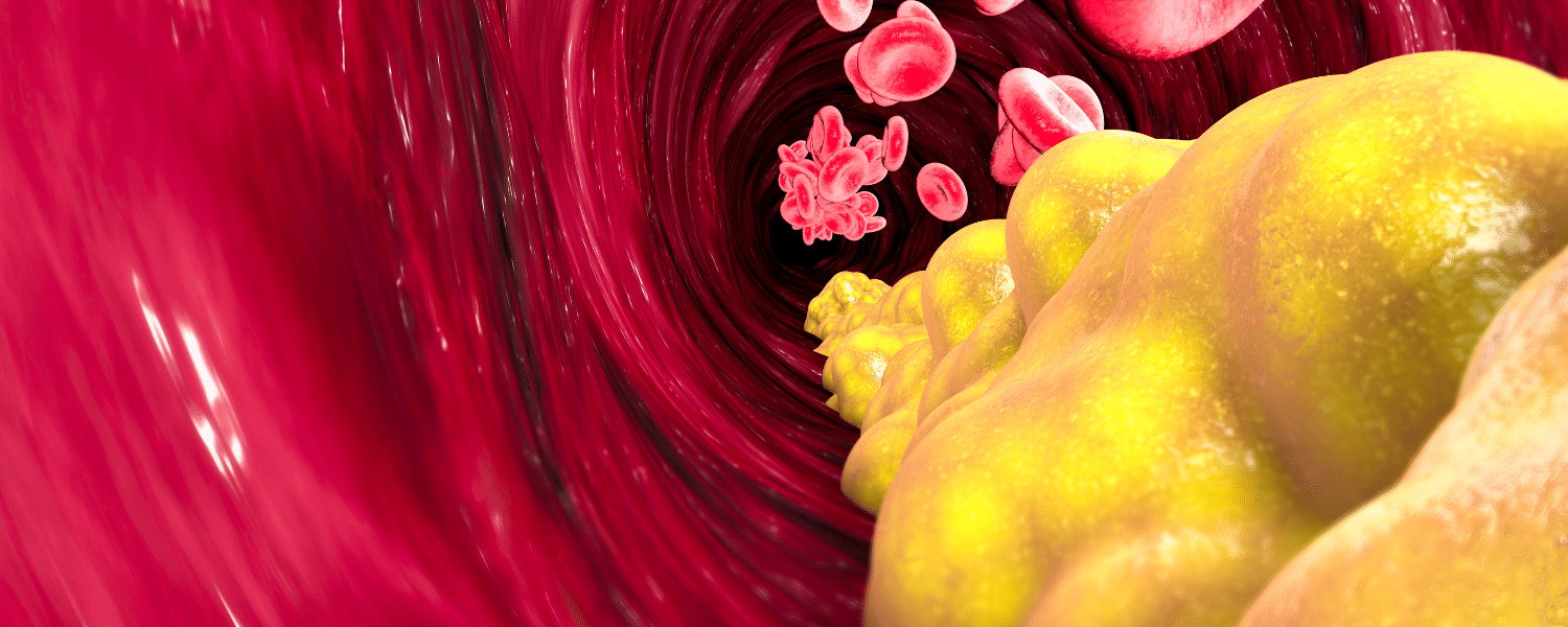 Produtos que ajudam a diminuir o colesterol alto